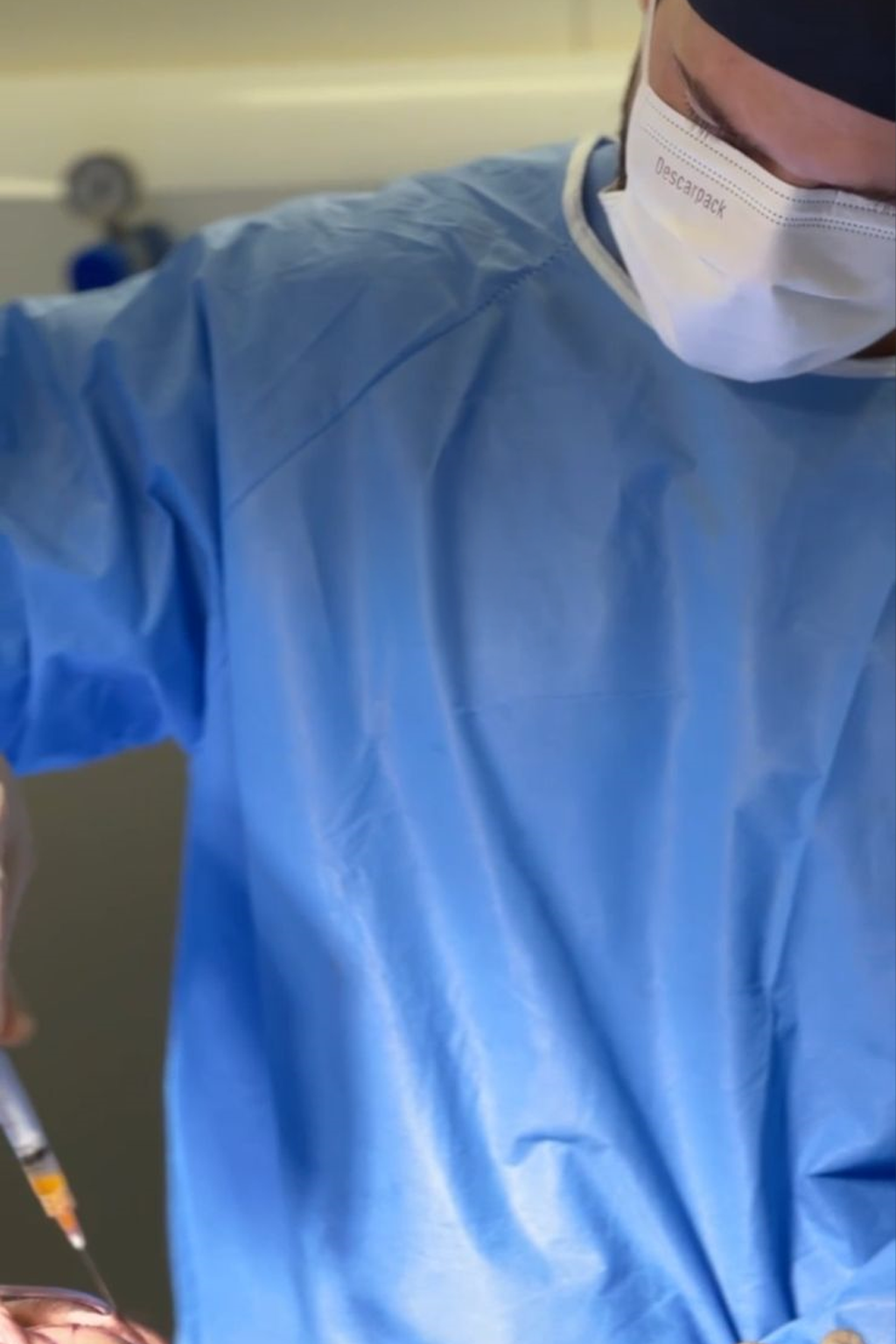 Lipoenxertia Facial -alfa-human-clinc